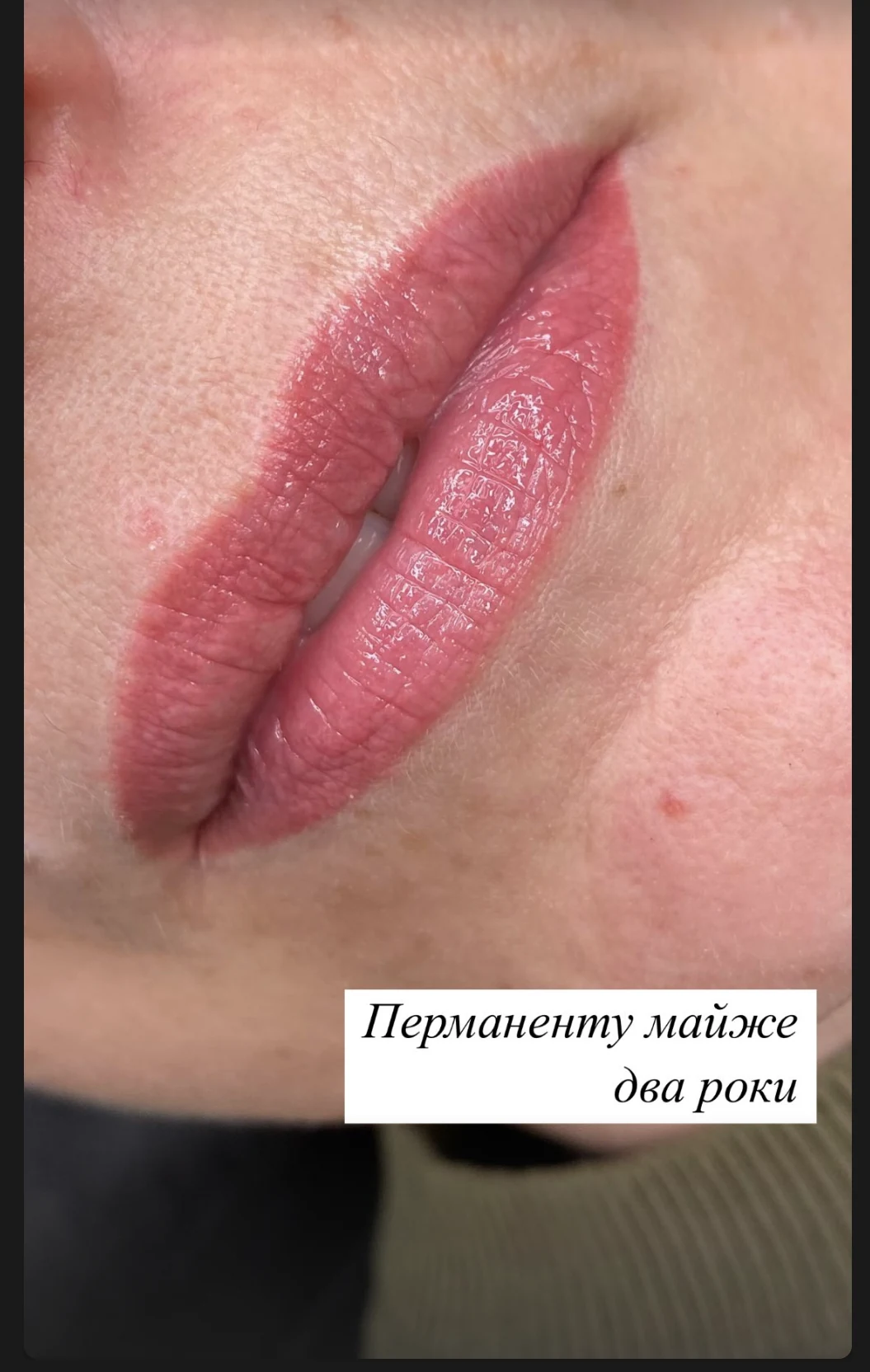 Губи через майже 2 роки після перманенту